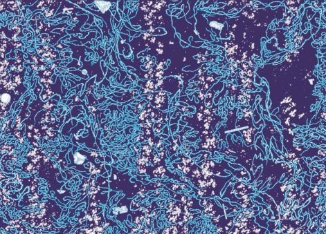 Loire Sentinelle - microplastiques ©Clément Vuillier