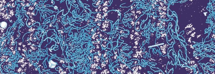 Loire Sentinelle - microplastiques ©Clément Vuillier